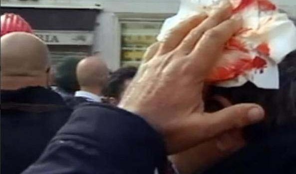 Redazione di Operai Contro, fuori dai salamelecchi fintodemocratici tipici di padroni, politici e sindacalisti nelle interviste in televisione o a mezzo stampa, davanti alle fabbriche e nei cortei cadono sempre più apertamente tutte le loro ipocrisie.   Le dure manganellate agli operai dell’Ast di Terni, le patetiche richieste di spiegazioni, chiarimenti e scuse invocate da Landini, Camusso e soci, le ipocrite assicurazioni di adeguati provvedimenti da parte del primo ministro Renzi e del ministro per lo sviluppo economico Guidi, la proposta della Guidi verso i sindacati Ast a scendere dai 550 esuberi previsti a un massimo di 290 per […]